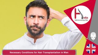 Necessary Conditions for Hair Transplantation in Men