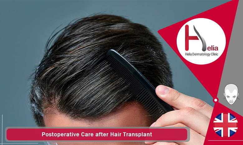 Postoperative Care after Hair Transplant