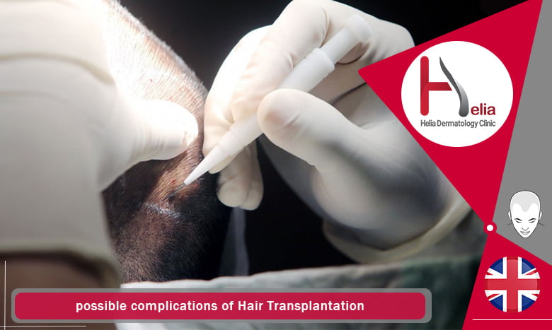 possible complications of Hair Transplantation