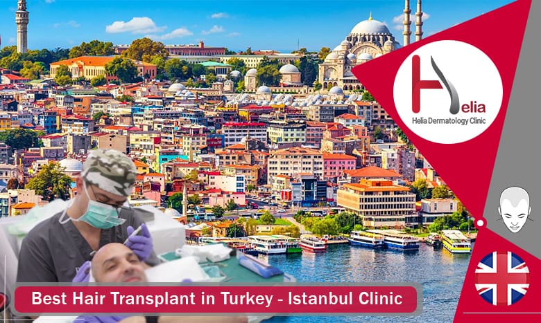 Best Hair Transplant in Turkey-Istanbul Clinic