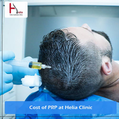 Cost of PRP at Helia Clinic