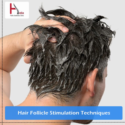 Hair Follicle Stimulation Techniques