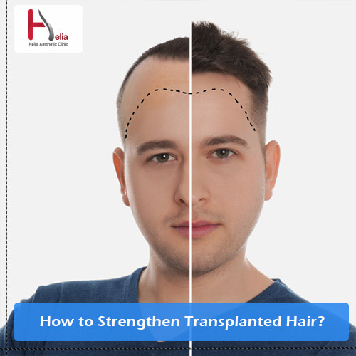 How to Strengthen Transplanted Hair?