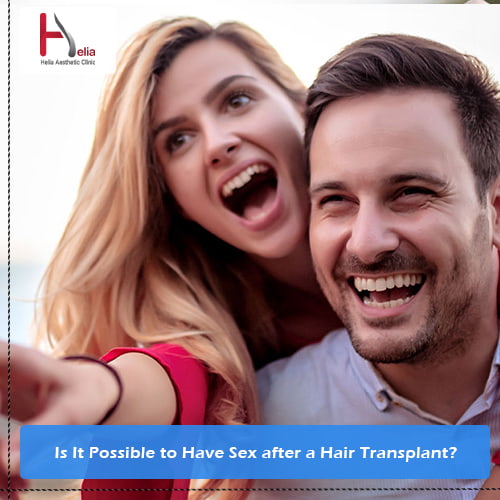 Is It Possible to Have Sex after a Hair Transplant?