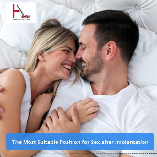 The Most Suitable Position for Sex after Implantation