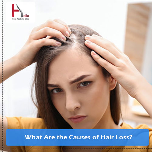 What Are the Causes of Hair Loss in Men and Women?