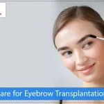 Care for Eyebrow Transplantation