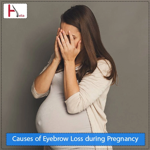 Causes of Eyebrow Loss during Pregnancy
