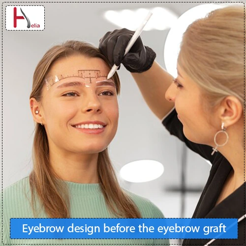 Eyebrow design before the eyebrow graft