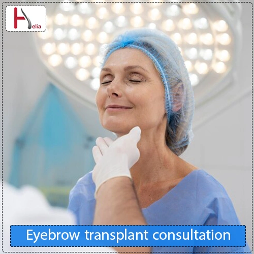 How is eyebrow transplant consultation done?