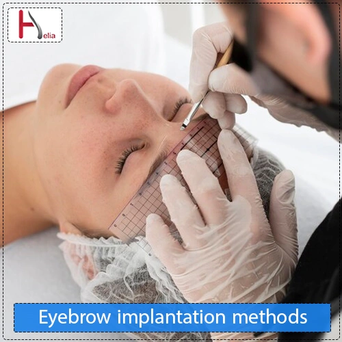 Methods of Eyebrow Transplantation