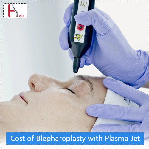 Cost of Blepharoplasty with Plasma Jet