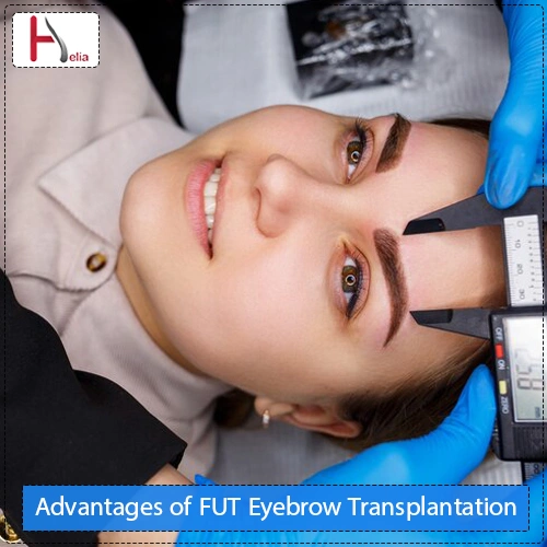 Advantages of FUT Eyebrow Transplantation