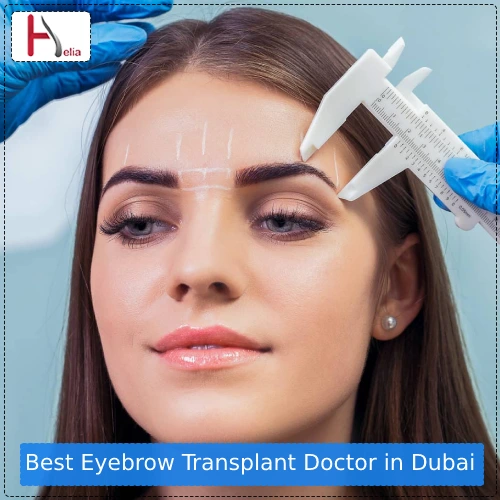 Best Eyebrow Transplant Doctor in Dubai