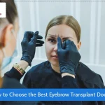 Best Eyebrow Transplant Doctor in Dubai