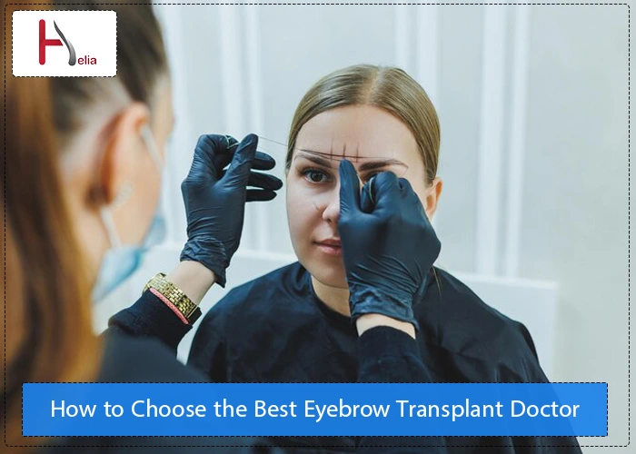 Best Eyebrow Transplant Doctor in Dubai