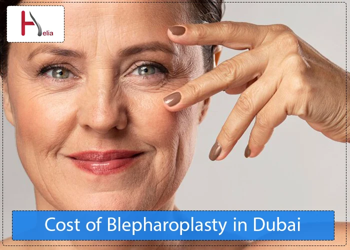 Cost of Blepharoplasty in Dubai