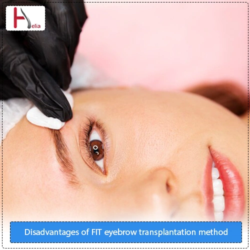 Disadvantages of the FIT eyebrow transplantation method