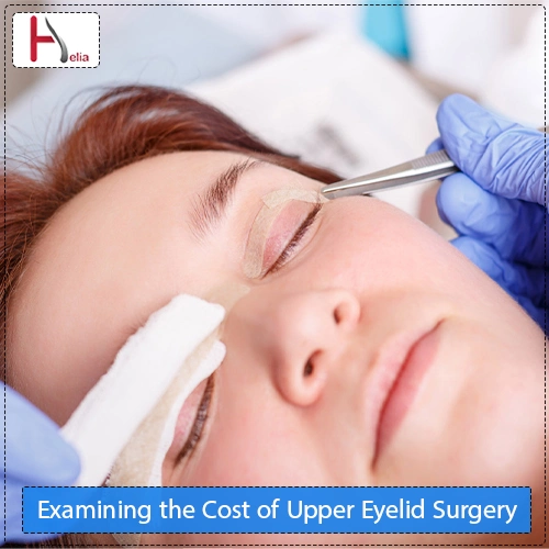 Examining the Cost of Upper Eyelid Surgery