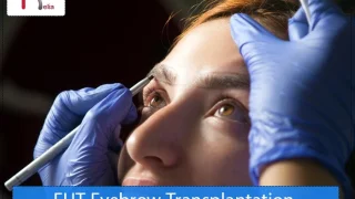 FUT Eyebrow Transplantation