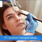 FIT Eyebrow Transplantation