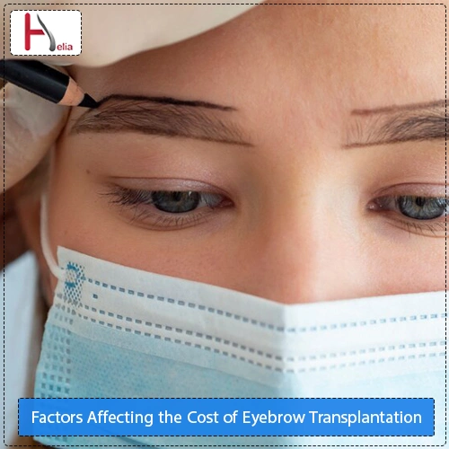 Factors Affecting the Cost of Eyebrow Transplantation
