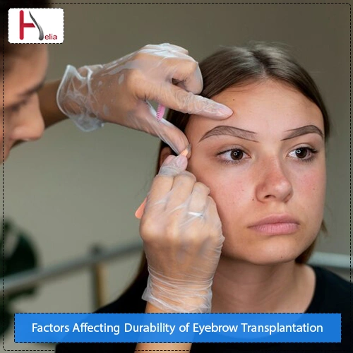 Factors Affecting the Longevity and Durability of Eyebrow Transplantation