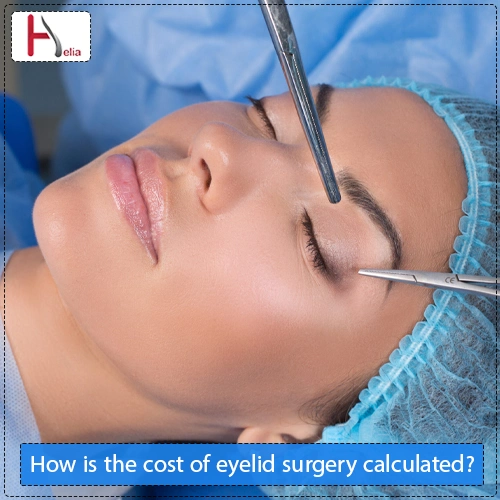 How is the cost of eyelid surgery calculated?