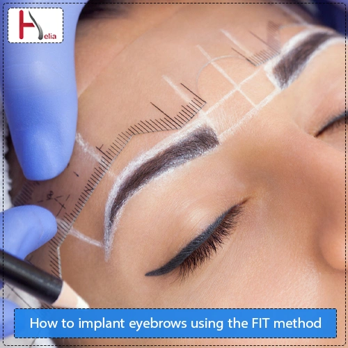 How to implant eyebrows using the FIT method