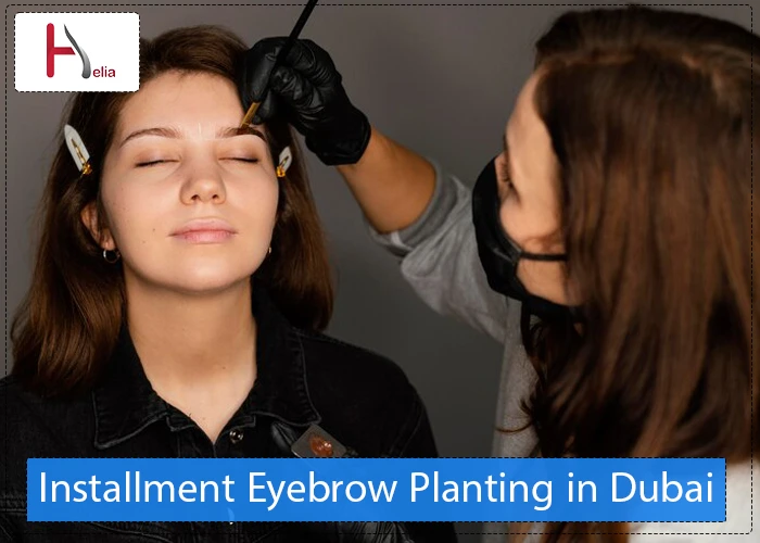 Installment Eyebrow Planting in Dubai