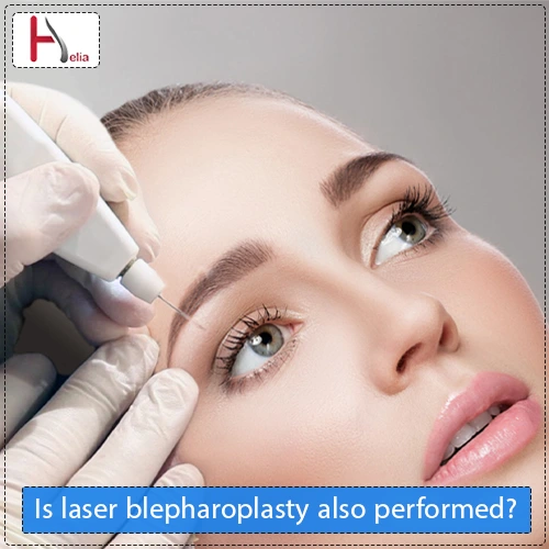 Is the result of laser blepharoplasty permanent?