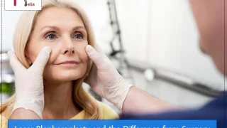 Laser Blepharoplasty and the Difference from Surgery