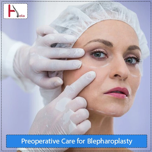 Preoperative Care for Blepharoplasty