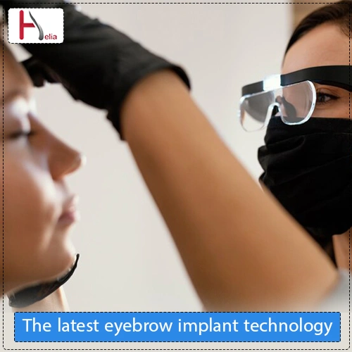 What is the latest technology for eyebrow implantation?
