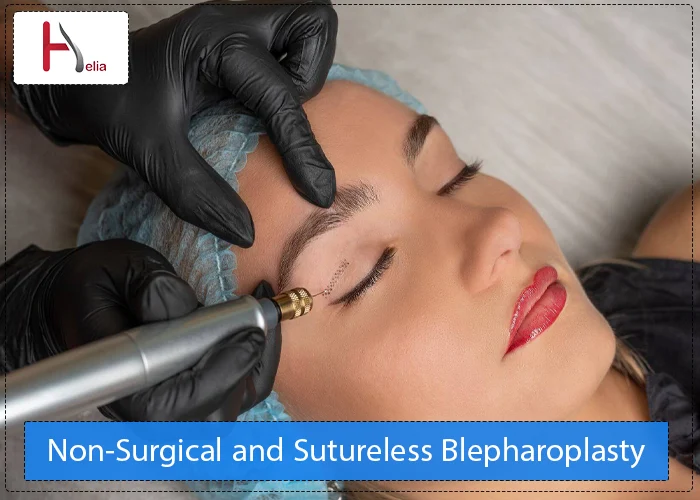 Non-Surgical and Sutureless Blepharoplasty