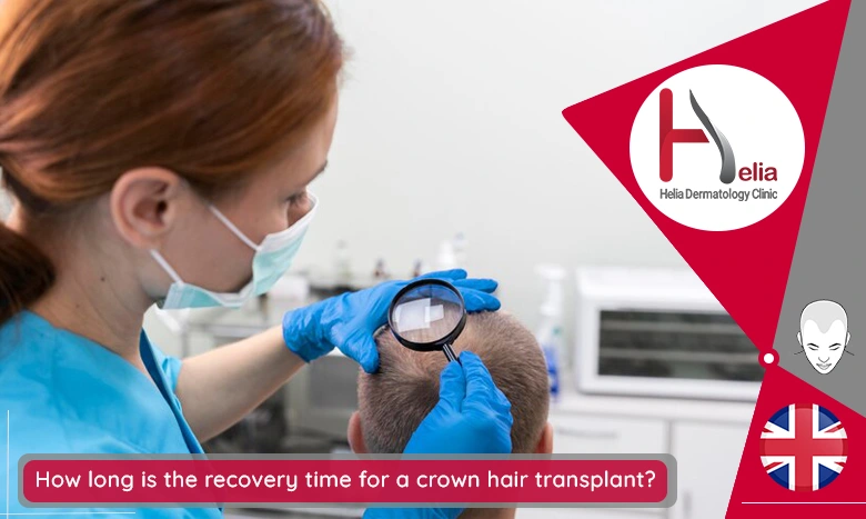 How long does a crown hair transplant take?