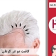 کاشت موی طبیعی در کرمان