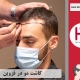 کاشت موی طبیعی در قزوین
