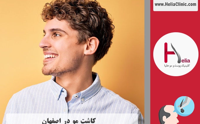 کاشت مو در اصفهان