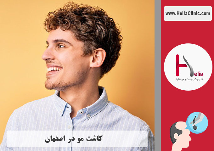 کاشت مو در اصفهان