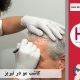 کاشت مو تبریز