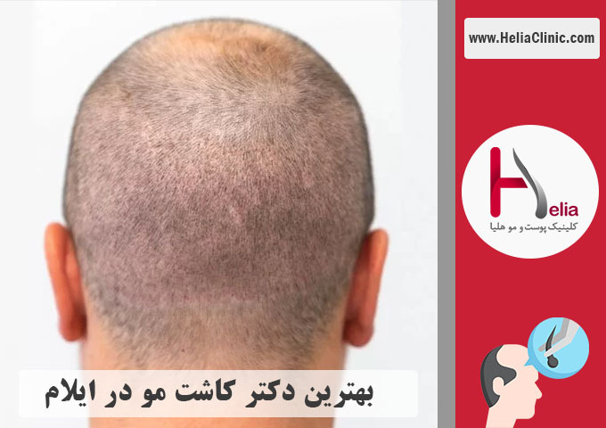 بهترین دکتر و کلینیک مجرب در شهر ایلام