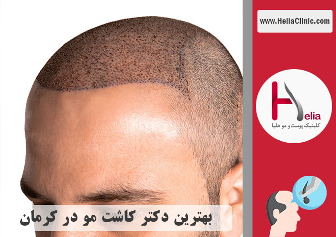 بهترین کلینیک و دکتر مجرب در کرمان