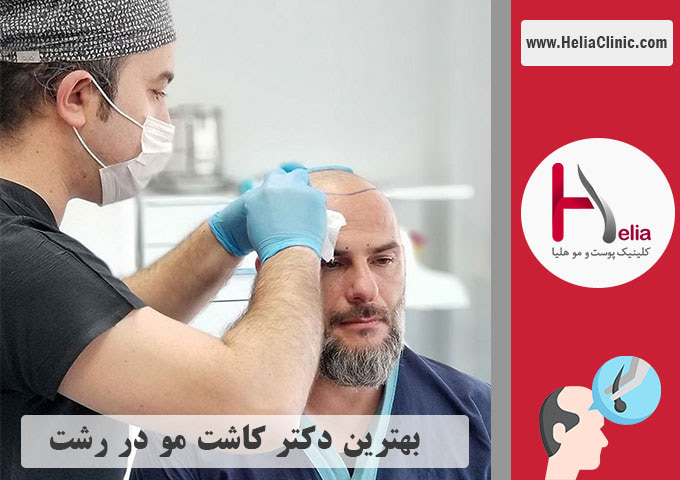بهترین دکتر متخصص و کلینیک کاشت مو در رشت