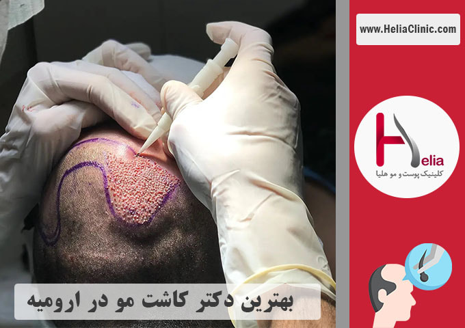 بهترین کلینیک و دکتر متخصص در شهر ارومیه