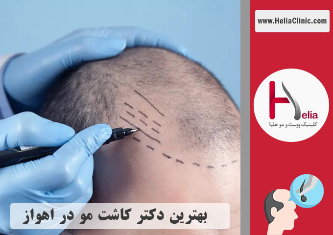 بهترین دکتر مجرب و کلینیک تخصصی در اهواز