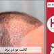 کاشت موی طبیعی در استان یزد