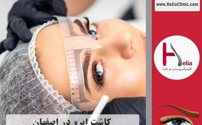 کاشت ابروی طبیعی در اصفهان