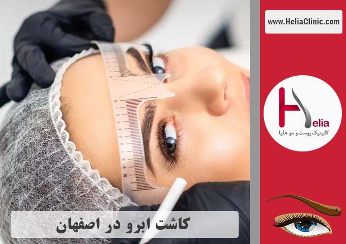 کاشت ابروی طبیعی در اصفهان