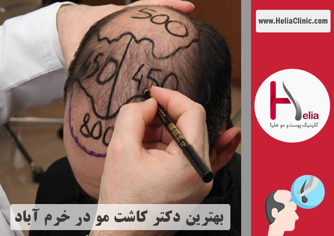 بهترین دکتر متخصص و کلینیک خوب در خرم آباد - لرستان